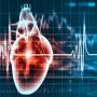 Cardiologie et chirurgie cardio